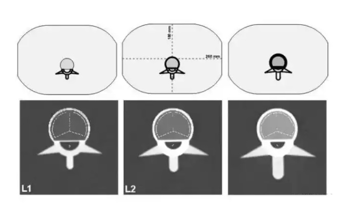 腰椎通用模體2 腰椎通用模體2